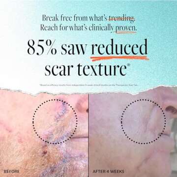 Derma E Scar Gel – Pain-free Scar Treatment for All