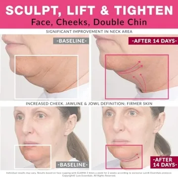 LURE Essentials Glam Facial Cupping Set for Radiant Skin