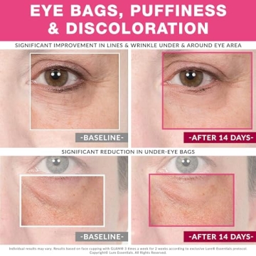 LURE Essentials Glam Facial Cupping Set for Radiant Skin