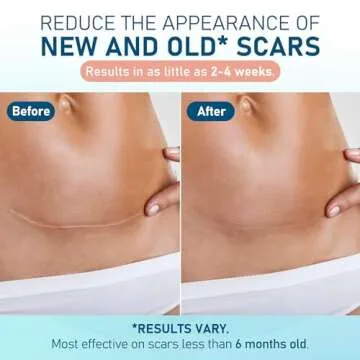 Silicone Scar Sheets - Effective Medical Treatment for Scars