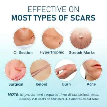 Silicone Scar Sheets - Effective Medical Treatment for Scars