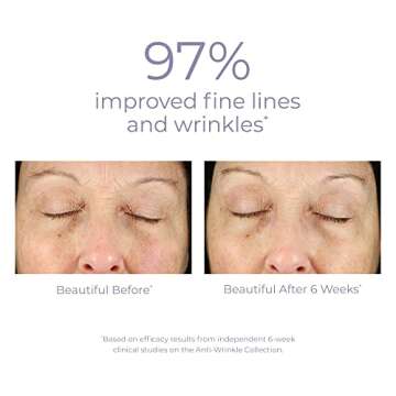 Derma E Anti-Wrinkle Renewal Skin Cream – Vitamin A Wrinkle Treatment Cream – Vegan Anti-Aging Moisturizer to Smooth & Renew Aging Skin, 4 oz