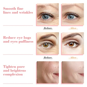 Slashome Ice Globes for Facials and Skincare