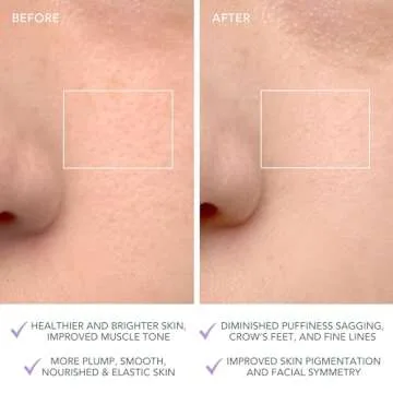 FOREO LUNA 4 Facial Cleansing Brush for Youthful Skin