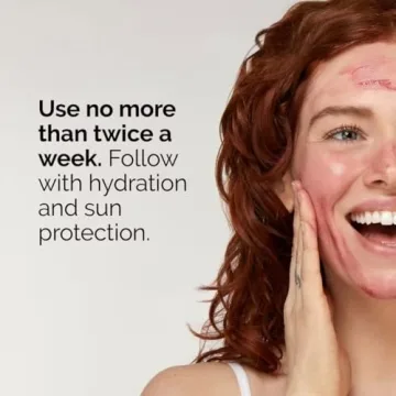 The Ordinary AHA 30% + BHA Peeling Solution - Exfoliate Today!