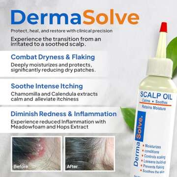 Dermasolve 4 oz Psoriasis, Seborrheic Dermatitis, & Dandruff Scalp Oil - Dermatologist Approved - Fl...