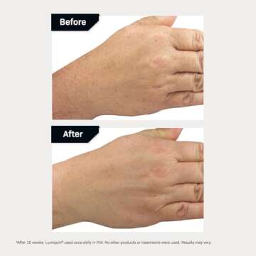 Revision Skincare Lumiquin® Hand Cream, Anti Aging Hand Moisturizer, Supports Moisture Barrier, Skin Brightening, 1.7 oz