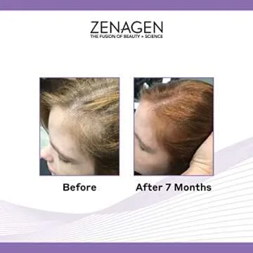 Zenagen Revolve Shampoo For Women | Supports Scalp Health & Appearance of Fuller, Healthier-Looking Hair, Developed for Fine & Visibly Thinning Hair, Plant-Based, Color-Safe, Vegan, For All Hair Types