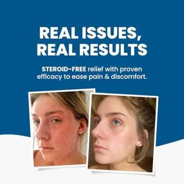 Grahams Natural C+ Eczema Relief Cream - Nourishes & Soothes Dermatitis, Inflammation, Redness Treatment for Irritated, Dry Skin - All Natural Ingredients with Manuka honey, Steroid-Free (1 x 1.76oz)