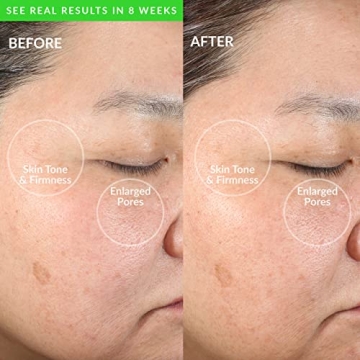 PMD Clean Smart Facial Cleansing Device for Radiant Skin