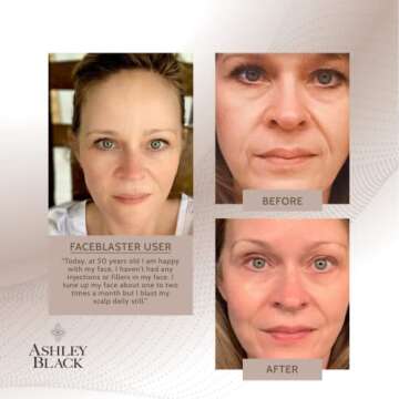 The FaceBlaster by Ashley Black. A Collagen Boosting, Fascia Remodeling, Skin Tightening, Face Contouring and Massaging Tool.