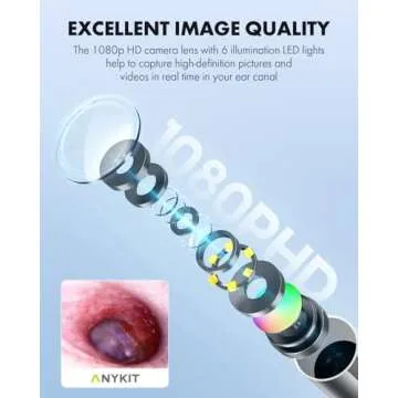 Anykit Digital Otoscope - HD Ear Camera with Tools