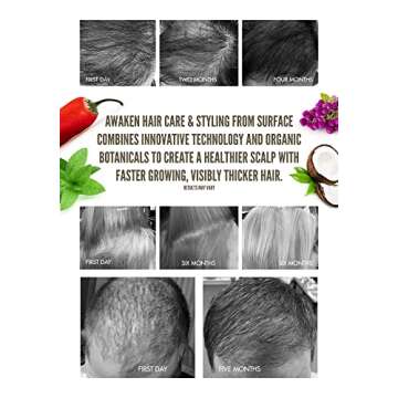 Surface Hair Awaken Kit: Shampoo, Conditioner, Scalp Elixir and Therapeutic Treatment - for Thinning Hair, Hair Loss and Thickening