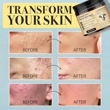 LINKTION Beef Tallow Honey Balm - All Natural Moisturizer