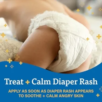 A+D Zinc Oxide Diaper Rash Cream for Quick Relief