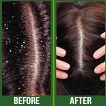 Difeel Premium Castor Plus Tea Tree Oil for Hair Growth