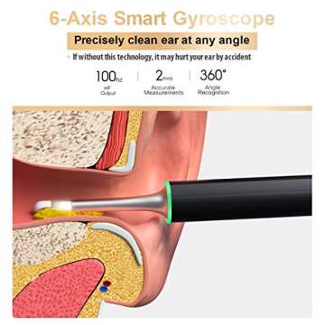 BEBIRD X17 Pro Ear Wax Removal Camera with 1080p HD & WiFi for Kids & Pets