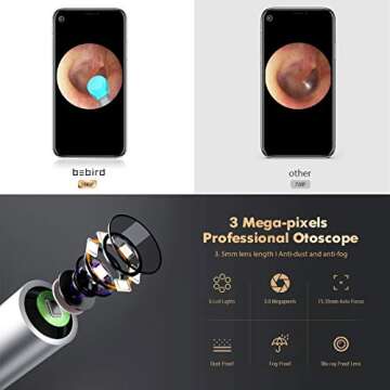 BEBIRD X17 Pro Ear Wax Removal Camera - 1080p Ear Cleaner