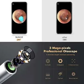 BEBIRD X17 Pro Ear Wax Removal Camera - 1080p Ear Cleaner