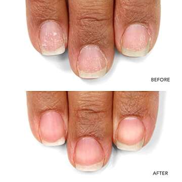 LONDONTOWN kur Nail Probiotic Instant Boost: Revitalize & Protect Your Nails