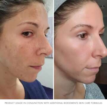 Bioelements Absolute Moisture - Lightweight Facial Moisturizer