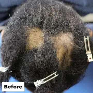 As I Am Hair Spray, Rice Water 16oz - with Forbidden Black Rice, Saw Palmetto, Biotin - Clean, Protein-Free Formula - Odor, Vegan & Cruelty Free - For All Hair Types