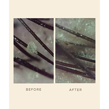 VEGAMOUR GRO Scalp Detox Serum - Zinc PCA for Healthier Hair