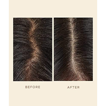 VEGAMOUR GRO Scalp Detox Serum - Zinc PCA for Healthier Hair