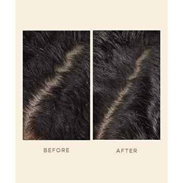 VEGAMOUR GRO Scalp Detox Serum - Zinc PCA for Healthier Hair