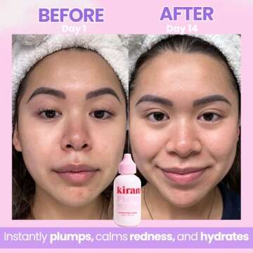 Kiramoon Flowermelon Hydrating Serum & Lightweight Daily Moisturizer to Reduce Dryness, Aloe + Chamomile + Niacinamide, All Skin Types including Sensitive Skin, Fragrance Free, Cruelty Free, 2 fl oz