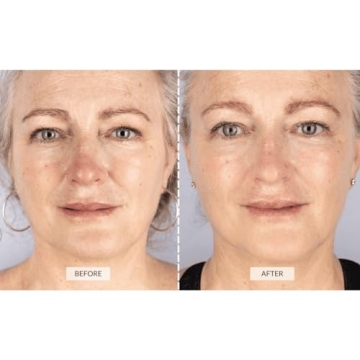 CurrentBody Skin LED Face Mask for Wrinkle Reduction