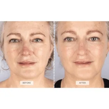 CurrentBody Skin LED Face Mask for Wrinkle Reduction