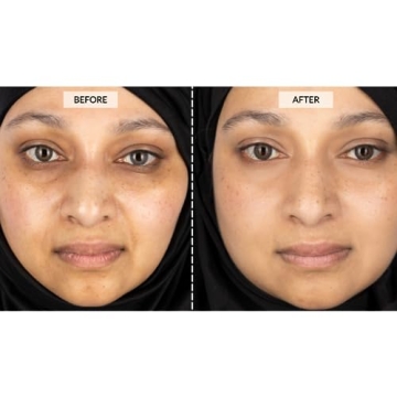 CurrentBody Skin LED Face Mask for Wrinkle Reduction