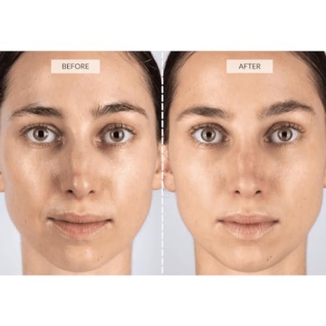 CurrentBody Skin LED Face Mask for Wrinkle Reduction