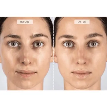 CurrentBody Skin LED Face Mask for Wrinkle Reduction
