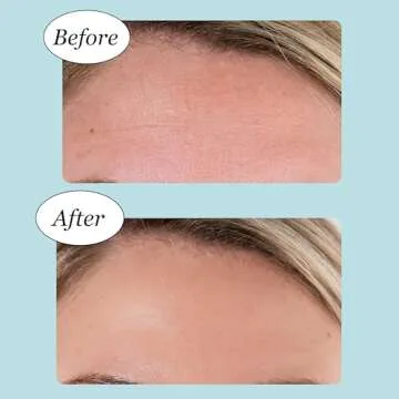 Jane Vine Forehead Wrinkle Patches - 20 Pcs Collagen Hydration