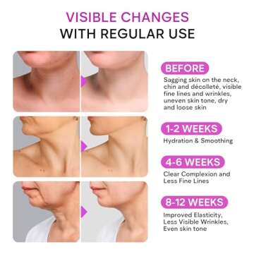 REMEDIAL PAX Neck Firming Cream: Anti-Aging Moisturizer with Retinol, Collagen & Hyaluronic Acid for Men & Women, 1.85 Fl Oz