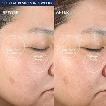 PMD Beauty Electric Facial Cleansing Brush for Radiance