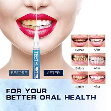 Teeth Whitening Pen, Use Twice a Day Up to 1-6 Shade Whiter in 1-2 Weeks, 4 No Sensitivity Pens, 70+...