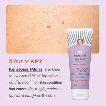 First Aid Beauty KP Bump Scrub with 10% AHA Exfoliator
