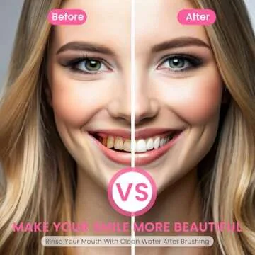 BodyAccel Niacinamide Whitening Toothpaste, BodyAccel Toothpaste, Niacinamide Intensive Whitening Toothpaste, Niacinamide Toothpaste, Stain Removal Toothpaste Natural, Fresh Breath (1)