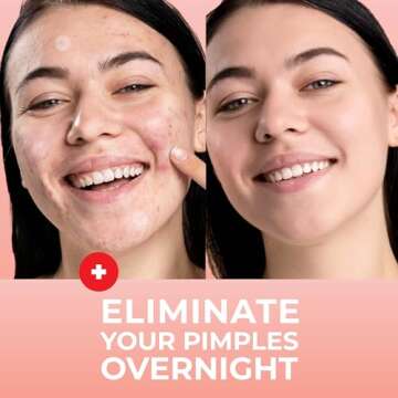 PatchRX Micro Needle Pimple Patch (18 Pack) - Hydrocolloid Micropoint Pimple Patch For Acne & Cystic Pimples, Eliminate Pimples Overnight, Microdart Pimple Patch, Micro Dart Pimple Patches