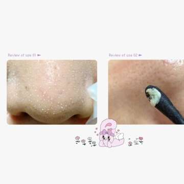 ilso Natural Mild Clear Nose Patch, Melt blackheads & Tighten Pores, no irritation, Korean skincare, cotton swabs included, 5 sheets (Esther Bunny Limited Edition) (PINK Esther Bunny Limited Edition)
