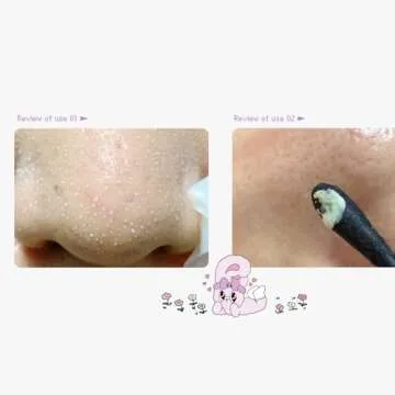 ilso Natural Mild Clear Nose Patch, Melt blackheads & Tighten Pores, no irritation, Korean skincare, cotton swabs included, 5 sheets (Esther Bunny Limited Edition) (PINK Esther Bunny Limited Edition)