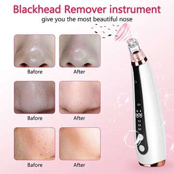 Blackhead Remover Electric Pore Cleanser with 6 Heads