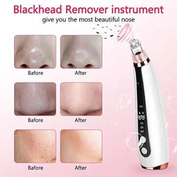 Blackhead Remover Electric Pore Cleanser with 6 Heads