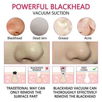 Blackhead Remover Electric Pore Cleanser with 6 Heads