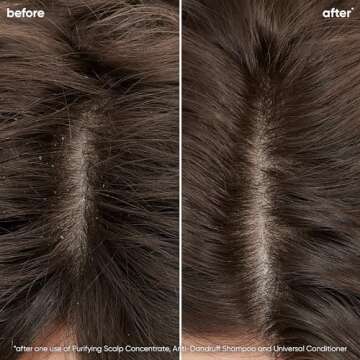 Biolage Scalp Sync Anti-Dandruff Shampoo | Targets Dandruff, Controls The Appearance of Flakes & Rel...