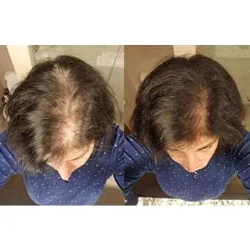 Zenagen Revolve Shampoo For Women | Supports Scalp Health & Appearance of Fuller, Healthier-Looking Hair, Developed for Fine & Visibly Thinning Hair, Plant-Based, Color-Safe, Vegan, For All Hair Types