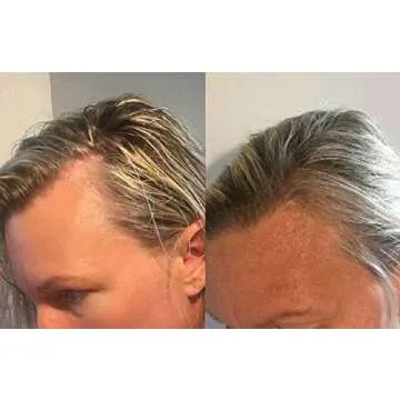 Zenagen Revolve Shampoo For Women | Supports Scalp Health & Appearance of Fuller, Healthier-Looking Hair, Developed for Fine & Visibly Thinning Hair, Plant-Based, Color-Safe, Vegan, For All Hair Types